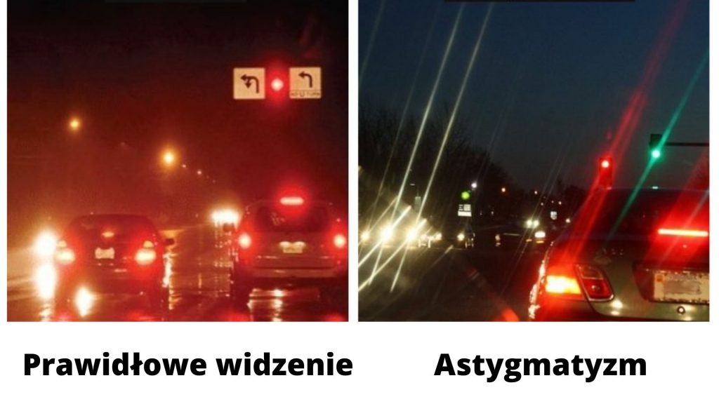 Astygmatyzm Jak Widzi Czy Mo na Go Wyleczy Wyja niamy 