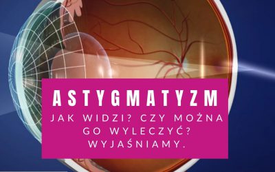 Astygmatyzm – Jak Widzi? Czy Można Go Wyleczyć? Wyjaśniamy.