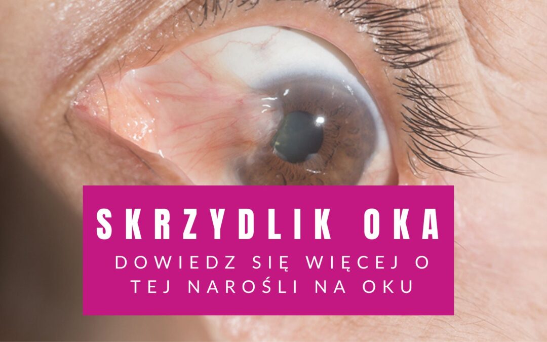 skrzydlik oka