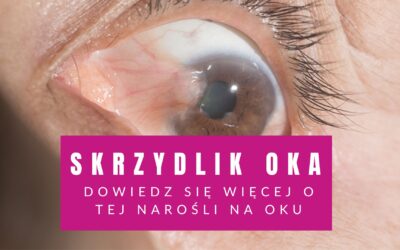 Skrzydlik Oka – Dowiedz Się Więcej O Tej Narośli Na Oku
