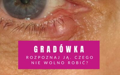 Gradówka Na Powiece – Rozpoznaj Ją. Czego Nie Wolno Robić?