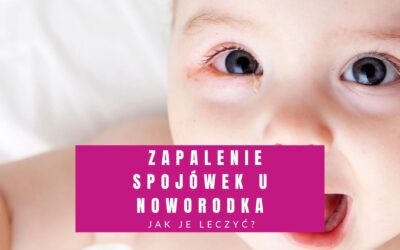 Zapalenie Spojówek U Noworodka – Jak Je Leczyć?