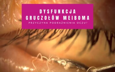 Dysfunkcja Gruczołów Meiboma – Przyczyna Podrażnienia Oczu
